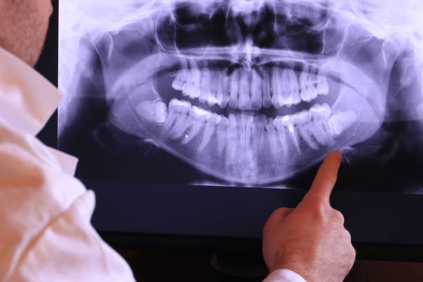 Best Walk-In Emergency Dental Services in Oak Ridge, NJ